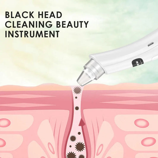 3 Suction Mode Face Vacuum Blackhead Removal Device