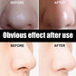 Bamboo Charcoal Nasal Strips Blackhead Remover Mask